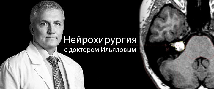 Нейрохирургия с доктором Ильяловым